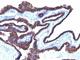 Keratin 8 antibody, V3114IHC-7ML, NSJ Bioreagents, Immunohistochemistry paraffin image 