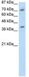 Zinc Finger Protein 282 antibody, TA343413, Origene, Western Blot image 