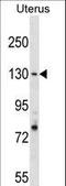 Replication factor C subunit 1 antibody, LS-C158838, Lifespan Biosciences, Western Blot image 