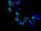 Phosphogluconate Dehydrogenase antibody, ab129199, Abcam, Immunocytochemistry image 