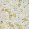 OXA1L Mitochondrial Inner Membrane Protein antibody, 22-110, ProSci, Immunohistochemistry paraffin image 