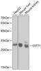 Glutathione S-Transferase Theta 1 antibody, GTX55652, GeneTex, Western Blot image 