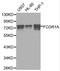 High affinity immunoglobulin gamma Fc receptor I antibody, LS-C192458, Lifespan Biosciences, Western Blot image 