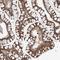 Coiled-Coil Domain Containing 18 antibody, NBP1-82504, Novus Biologicals, Immunohistochemistry frozen image 
