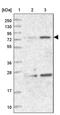 NHL Repeat Containing 2 antibody, PA5-58414, Invitrogen Antibodies, Western Blot image 