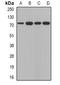 Calpain 5 antibody, orb341299, Biorbyt, Western Blot image 