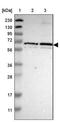 Zona Pellucida Glycoprotein 2 antibody, NBP1-86103, Novus Biologicals, Western Blot image 