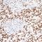 Metastasis Associated 1 antibody, A300-911A, Bethyl Labs, Immunohistochemistry paraffin image 