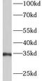 Annexin A5 antibody, FNab09988, FineTest, Western Blot image 