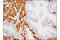 Calponin 1 antibody, 17819S, Cell Signaling Technology, Immunohistochemistry paraffin image 