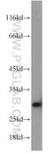 Small Nuclear Ribonucleoprotein Polypeptide N antibody, 11070-1-AP, Proteintech Group, Western Blot image 