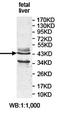 Pipecolic Acid And Sarcosine Oxidase antibody, orb78268, Biorbyt, Western Blot image 