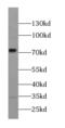 G Protein Signaling Modulator 1 antibody, FNab00221, FineTest, Western Blot image 