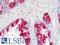 Menin 1 antibody, LS-B11066, Lifespan Biosciences, Immunohistochemistry paraffin image 