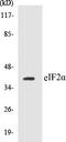 Eukaryotic Translation Initiation Factor 2 Subunit Alpha antibody, EKC1186, Boster Biological Technology, Western Blot image 