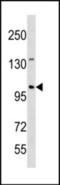 Establishment Of Sister Chromatid Cohesion N-Acetyltransferase 1 antibody, orb314846, Biorbyt, Western Blot image 