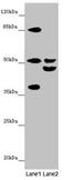 Nyctalopin antibody, orb41004, Biorbyt, Western Blot image 