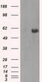 RAC-beta serine/threonine-protein kinase antibody, TA500814S, Origene, Western Blot image 