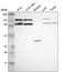 Chloride Voltage-Gated Channel 5 antibody, PA5-64891, Invitrogen Antibodies, Western Blot image 