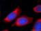 Ribosomal Protein L22 antibody, 25002-1-AP, Proteintech Group, Immunofluorescence image 