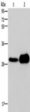 Killer Cell Lectin Like Receptor B1 antibody, TA349763, Origene, Western Blot image 