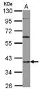 Heterogeneous Nuclear Ribonucleoprotein D antibody, LS-C155186, Lifespan Biosciences, Western Blot image 