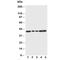 Decorin antibody, R30372, NSJ Bioreagents, Western Blot image 