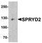 Cardiomyopathy Associated 5 antibody, A08262, Boster Biological Technology, Western Blot image 