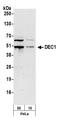 Basic Helix-Loop-Helix Family Member E40 antibody, A300-649A, Bethyl Labs, Western Blot image 
