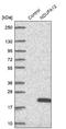 NADH:Ubiquinone Oxidoreductase Subunit A12 antibody, NBP1-88935, Novus Biologicals, Western Blot image 