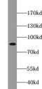 ArfGAP With Coiled-Coil, Ankyrin Repeat And PH Domains 2 antibody, FNab00070, FineTest, Western Blot image 