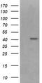 Parvin Alpha antibody, TA505992S, Origene, Western Blot image 