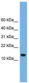 LSM8 Homolog, U6 Small Nuclear RNA Associated antibody, TA343843, Origene, Western Blot image 
