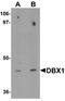 Homeobox protein DBX1 antibody, A14046, Boster Biological Technology, Western Blot image 