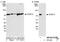 CPSF73 antibody, NB100-57529, Novus Biologicals, Western Blot image 