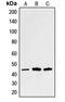 Sarcoglycan Alpha antibody, LS-C352833, Lifespan Biosciences, Western Blot image 