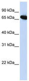 Homeobox protein DLX-4 antibody, TA335858, Origene, Western Blot image 