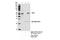 Adrenocortical dysplasia protein antibody, 14667S, Cell Signaling Technology, Immunoprecipitation image 