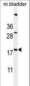 Succinate Dehydrogenase Complex Assembly Factor 3 antibody, LS-C155939, Lifespan Biosciences, Western Blot image 
