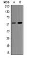 NIMA Related Kinase 2 antibody, orb381910, Biorbyt, Western Blot image 