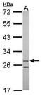 15-Hydroxyprostaglandin Dehydrogenase antibody, GTX113740, GeneTex, Western Blot image 