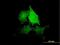 Tensin 4 antibody, H00084951-B01P, Novus Biologicals, Immunocytochemistry image 