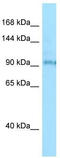 Bardet-Biedl Syndrome 9 antibody, TA338088, Origene, Western Blot image 