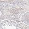 Transglutaminase 2 antibody, HPA029518, Atlas Antibodies, Immunohistochemistry paraffin image 