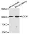 Adenylate cyclase type 1 antibody, STJ111819, St John