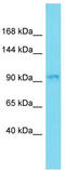 Rho GTPase Activating Protein 33 antibody, TA333567, Origene, Western Blot image 
