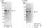 Vacuolar Protein Sorting 72 Homolog antibody, A303-115A, Bethyl Labs, Western Blot image 