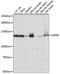 Kinesin Family Member 5B antibody, GTX66352, GeneTex, Western Blot image 