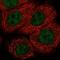 Von Hippel-Lindau disease tumor suppressor antibody, NBP2-55329, Novus Biologicals, Immunofluorescence image 