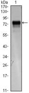Fms Related Tyrosine Kinase 4 antibody, M01276, Boster Biological Technology, Western Blot image 